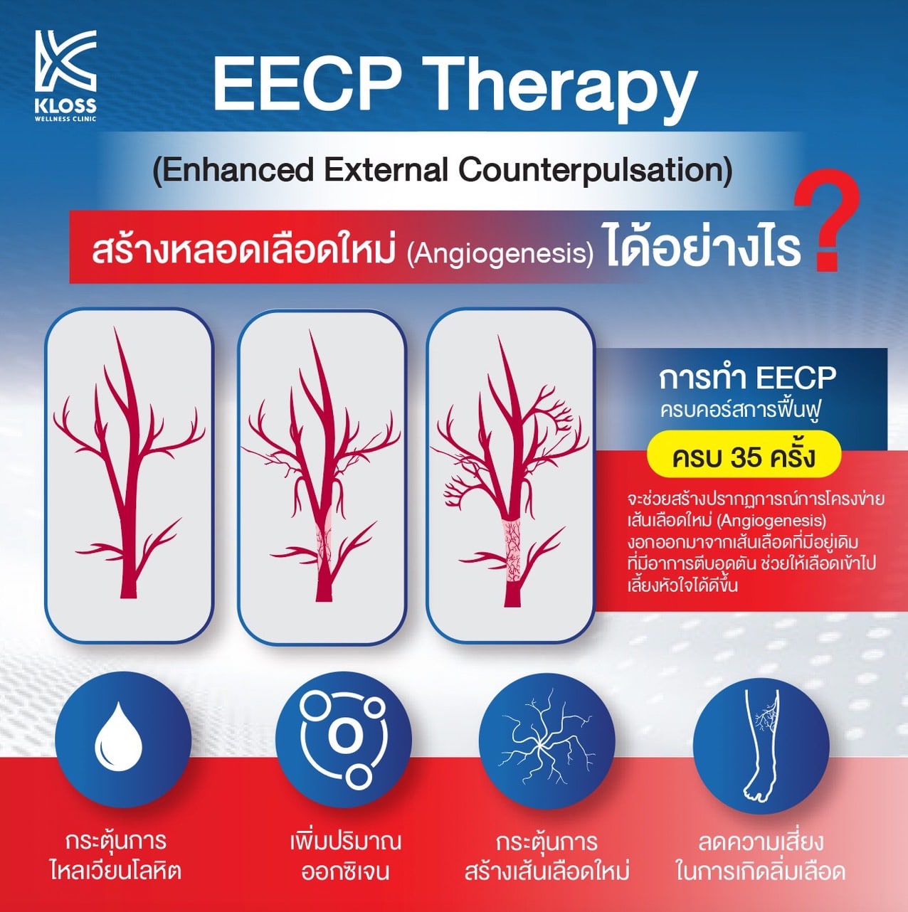 Natural Bypass คืออะไร ?  สร้างหลอดเลือดใหม่ ช่วยให้หัวใจแข็งแรง